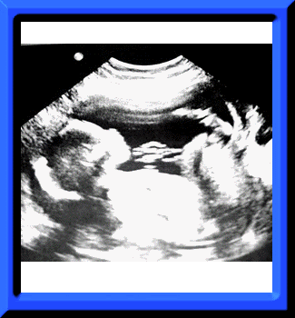 maxxdone3.gif