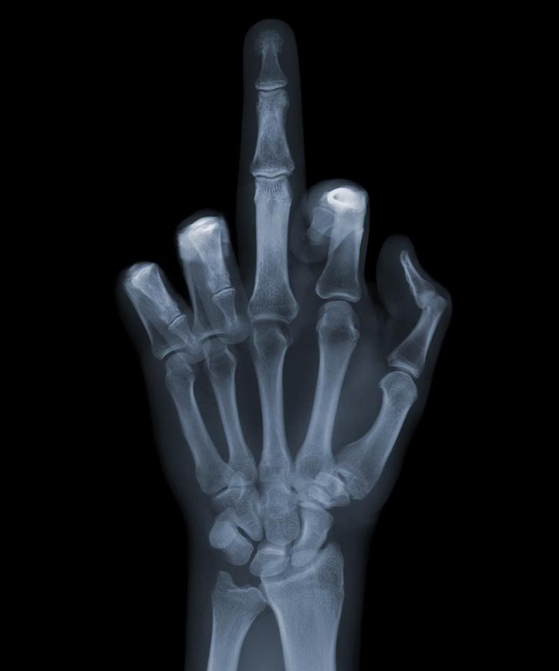 middle-finger-x-ray.jpg